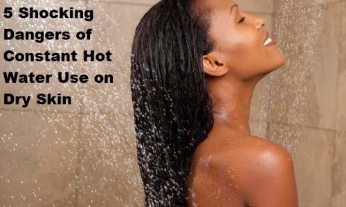 5 Shocking Dangers of Constant Hot Water Use on Dry Skin