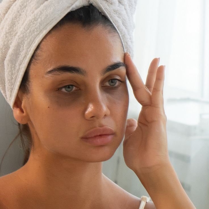 5 Proven Home Remedies to Remove Dark Circles Naturally (2025)