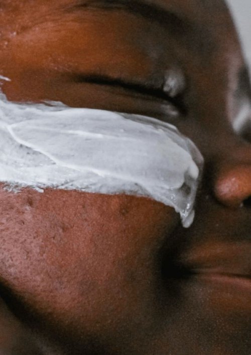 The Benefits of Using Lactic Acid for Brighter, Smoother Skin in Nigeria